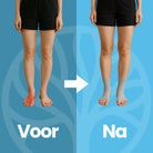 Compressiekousen gedragen voor ondersteuning van de bloedsomloop in het onderbeen
