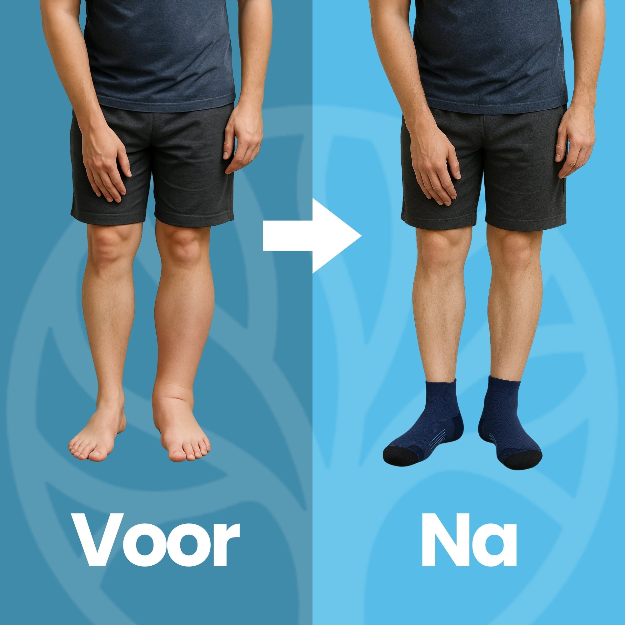 Compressiesokken tegen beenpijn en kniepijn