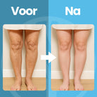 Voetpijn verlichting met EMS apparaat zonder medicijnen