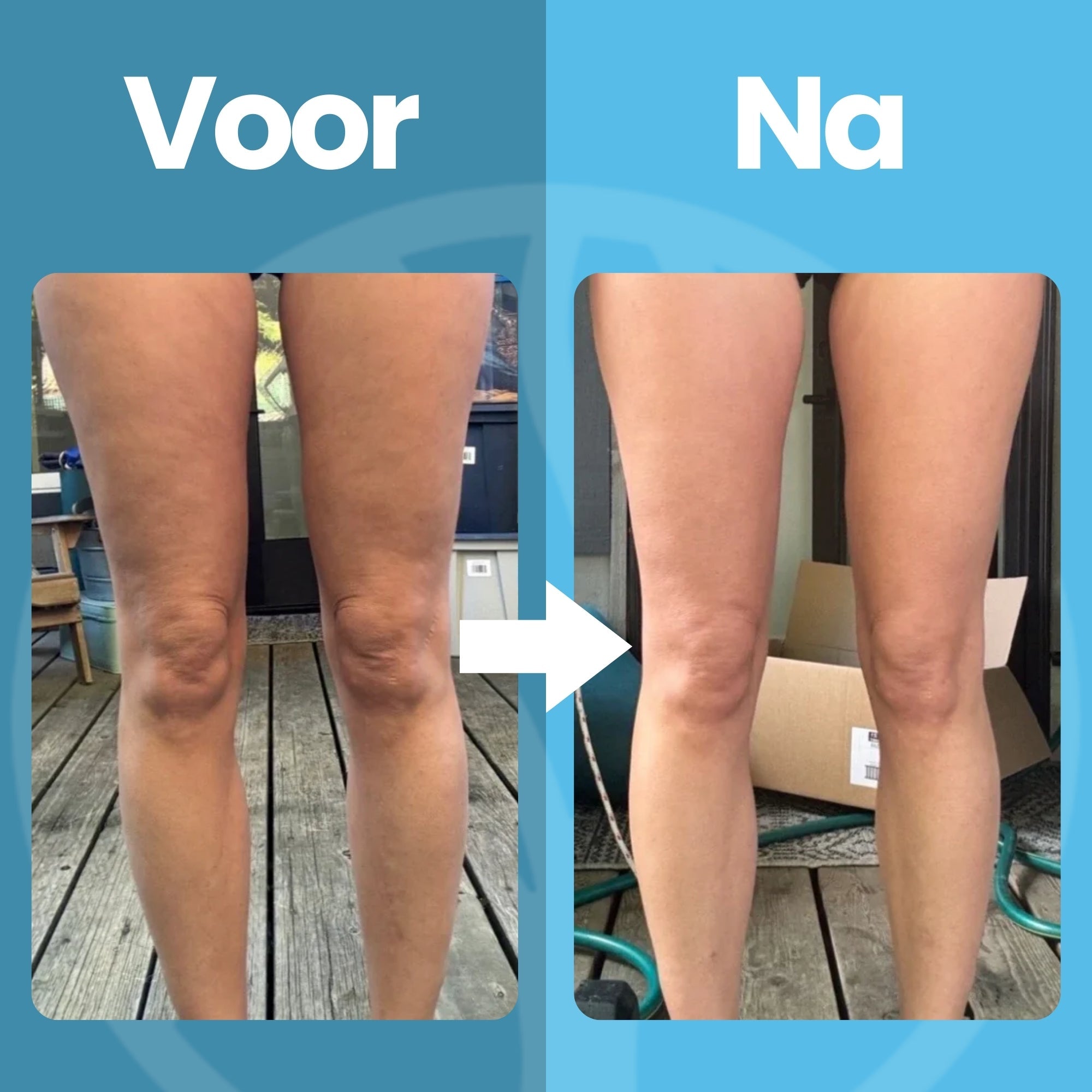Lumivo body toning massager volledig vooraanzicht