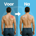 Nervio TENS-apparaat voor hoofdpijn behandeling thuis