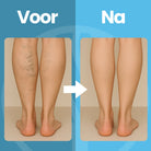 Orthopedische hoge kousen 20-30 mmHg compressie vooraanzicht