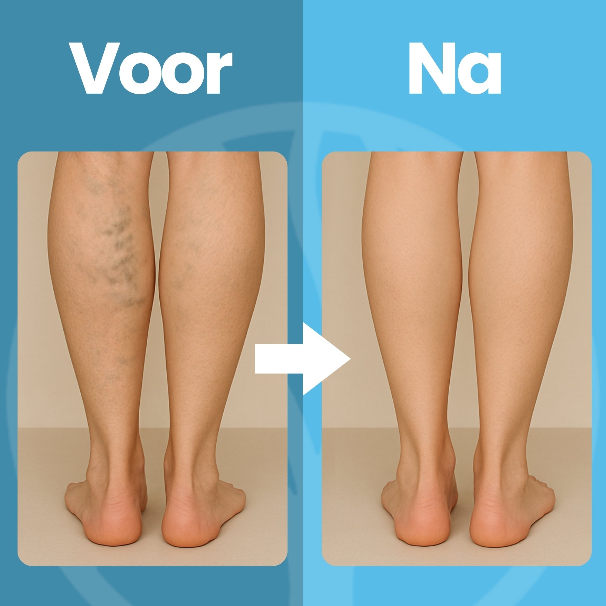 Orthopedische hoge kousen 20-30 mmHg compressie vooraanzicht